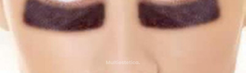 El+Himen+Imagenes Clínica Médica Estética Doctora Barba Martínez