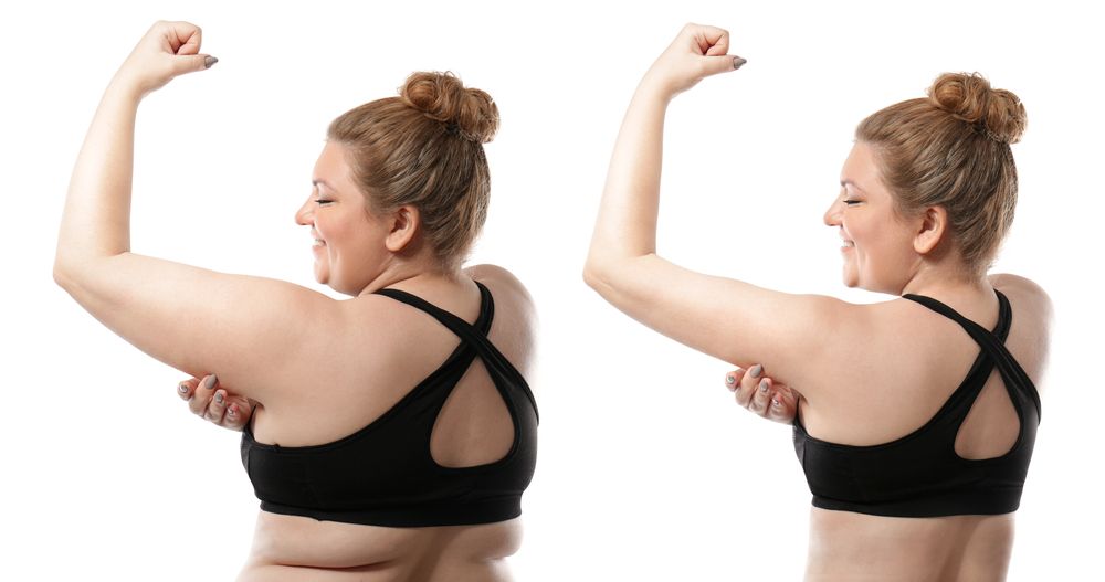 Para prevenir la flacidez es necesario ser contante y mantener una dieta rica en proteínas y antioxidantes