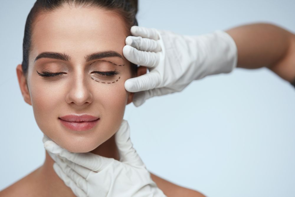 blefaroplastia-tratamiento-parpados