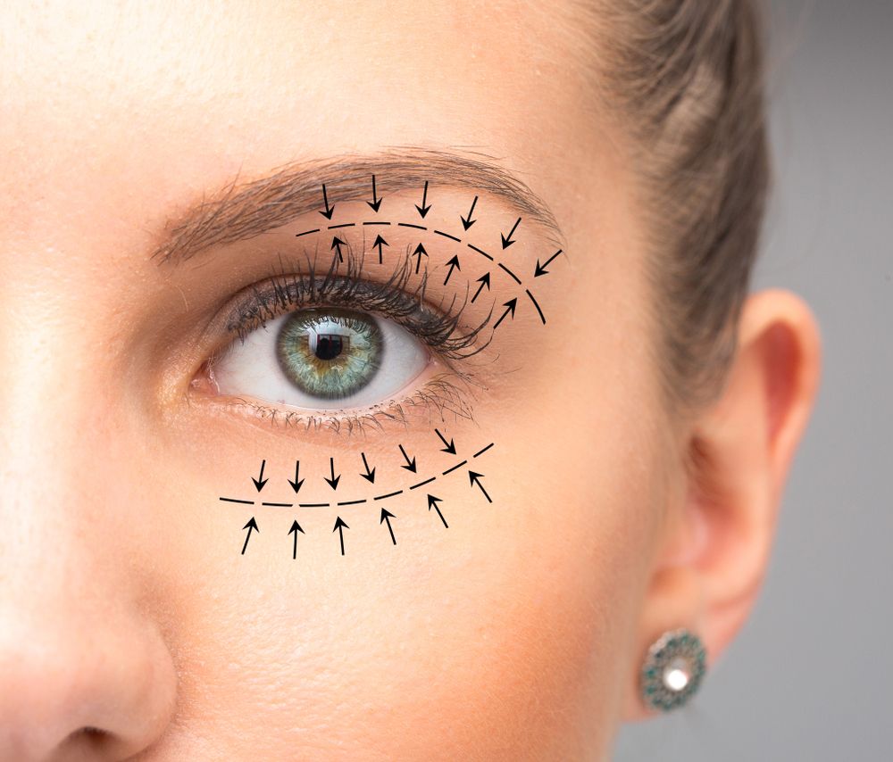 blefaroplastia-parpados-mujer.jpg