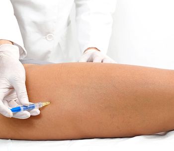 ¿Qué es la mesoterapia y para qué sirve?