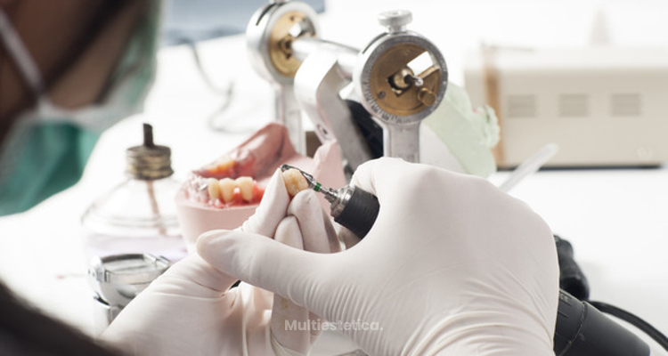 Protesis dental fija antes y despues de adelgazar Protesis dental fija antes y despues de adelgazar