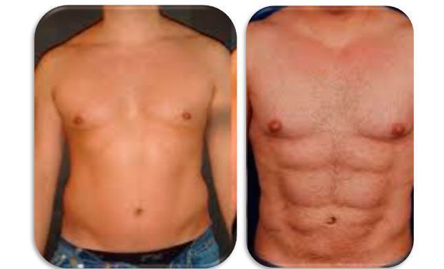 liposuccion-antes-y-despues-barcelona-007.jpg